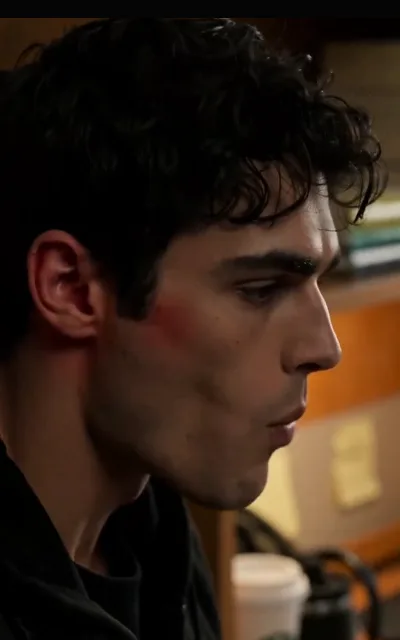 A scrape along a cheekbone in the aftermath of the pack conflict — the cost of the arc marked on a face, staged exactly as shot with nothing graphic amplified (ep4; battle-aftermath frame as aired)
