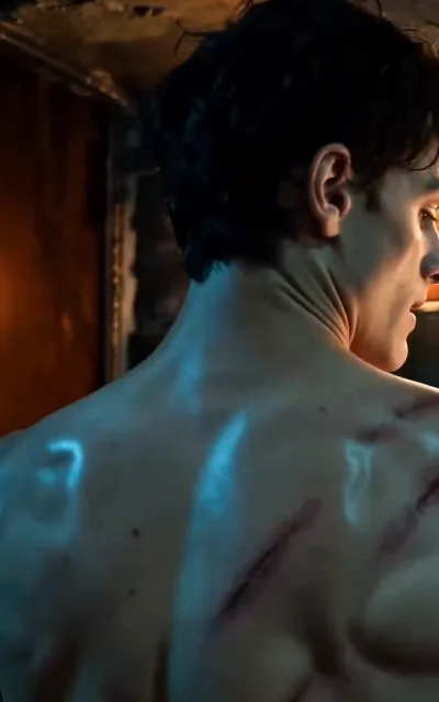 Julian's bare back under cold light, fresh red welts across his shoulder blades